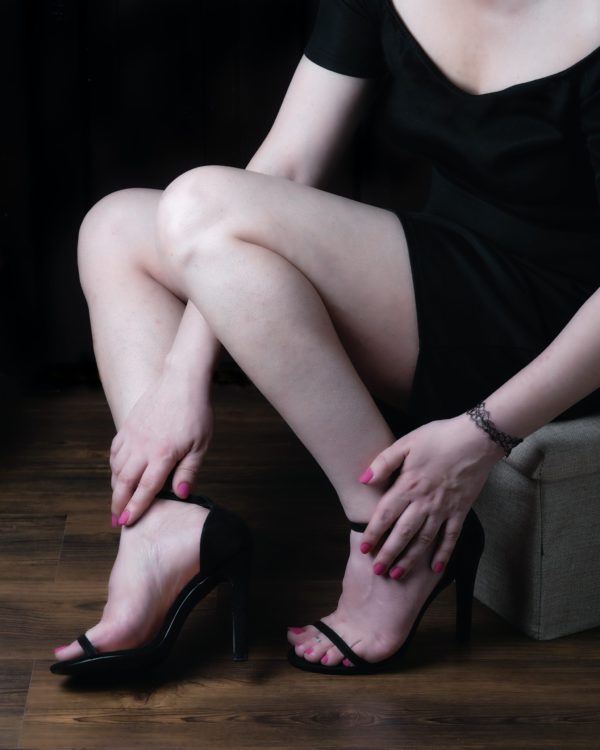 무지외반증 비틀린 발가락! 방치하면 허리까지 골병