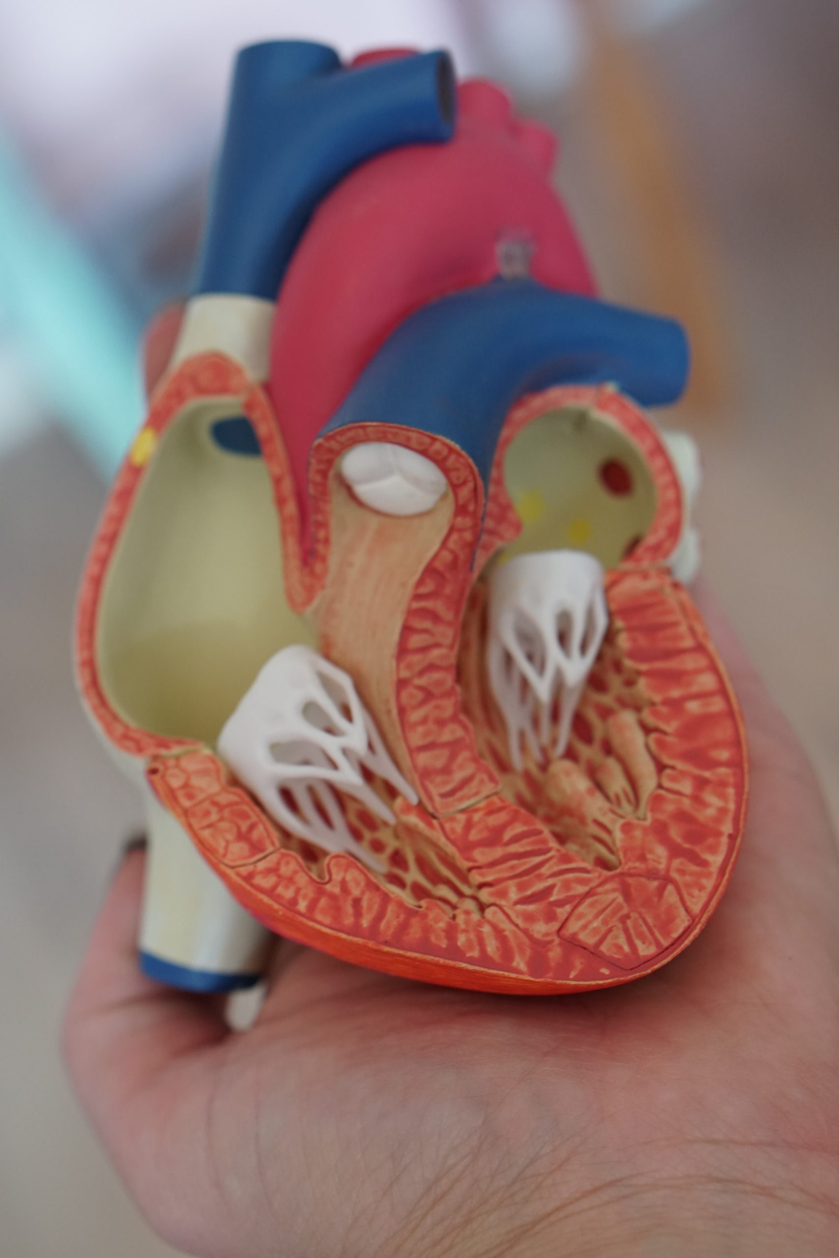 폐렴